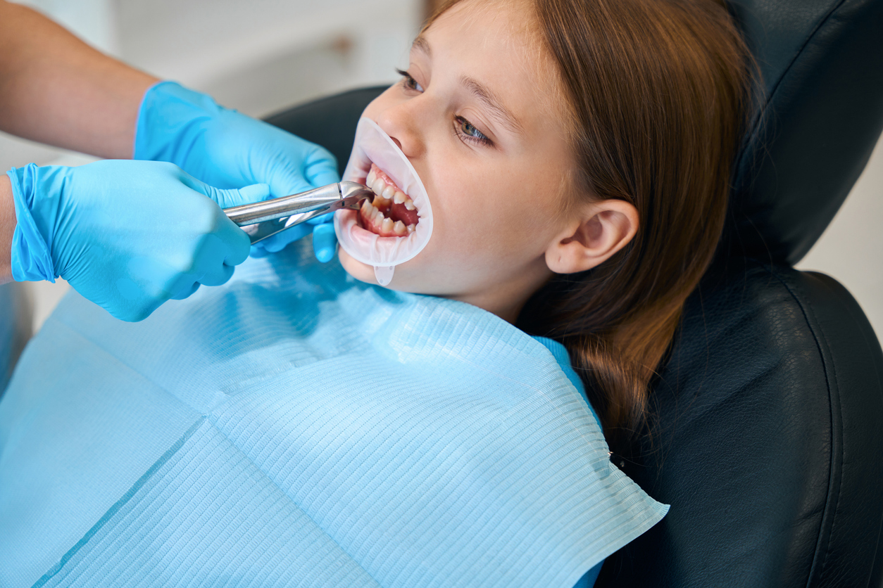 pediatric tooth extractions